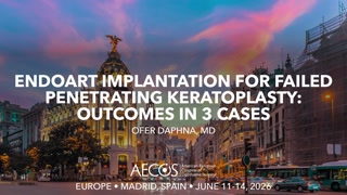 EndoArt Implantation for Failed Penetrating Keratoplasty- Outcomes in 3 Cases.mp4